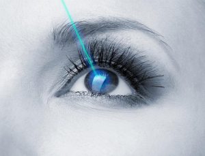 Преимущества лазерной коррекции зрения